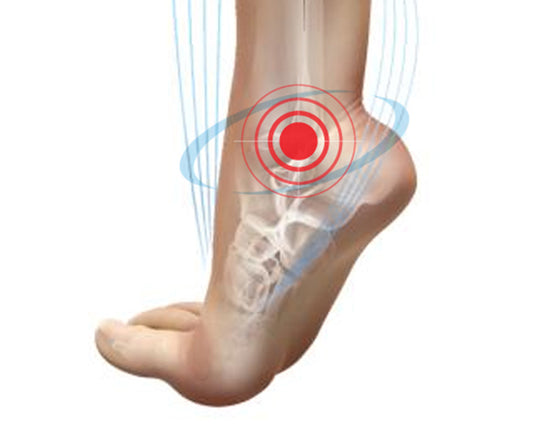 Over Pronation & Supination